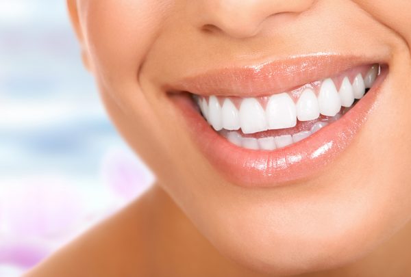 sourire-600x405-1